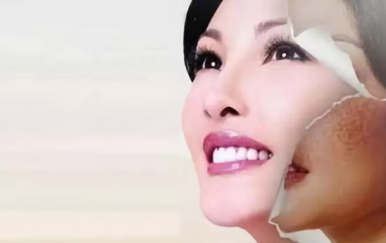 一年中最佳的祛斑時間，那無疑是秋季。